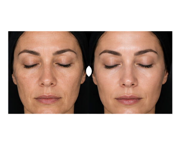 Anti Ageing Skincare Products in Dubai