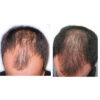 hair2