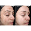 melanoceuticals1