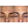 melanoceuticals2